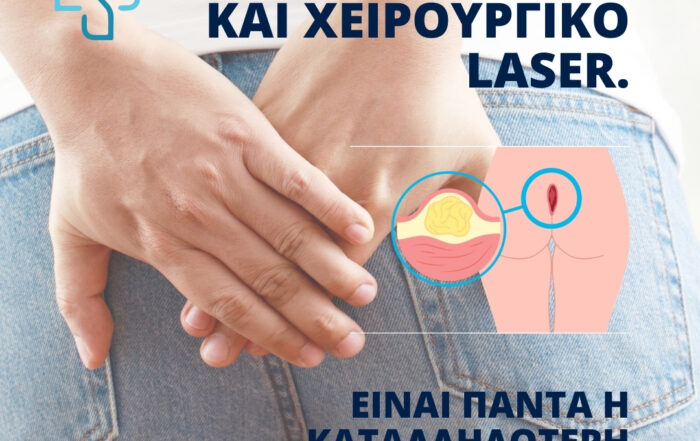 Κύστη κόκκυγος και χειρουργικό Laser