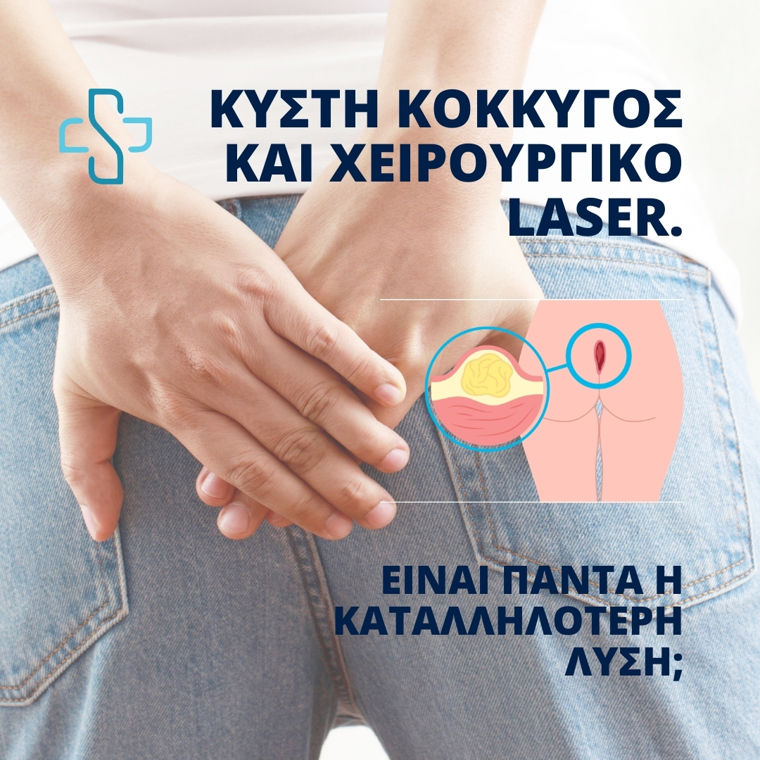 Κύστη κόκκυγος και χειρουργικό Laser