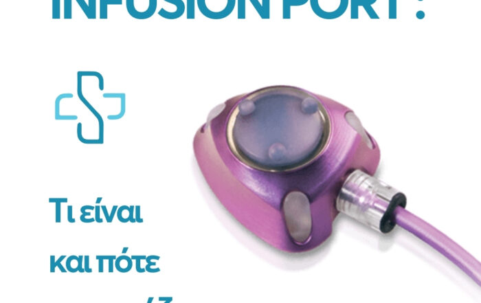 Infusion port: Τι είναι και πότε το χρειάζεστε;