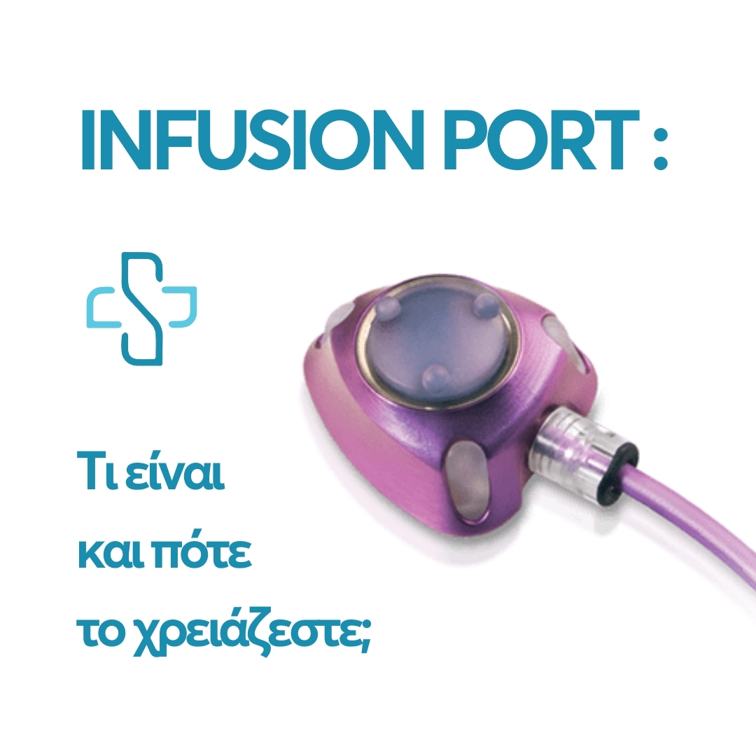 Infusion port: Τι είναι και πότε το χρειάζεστε;